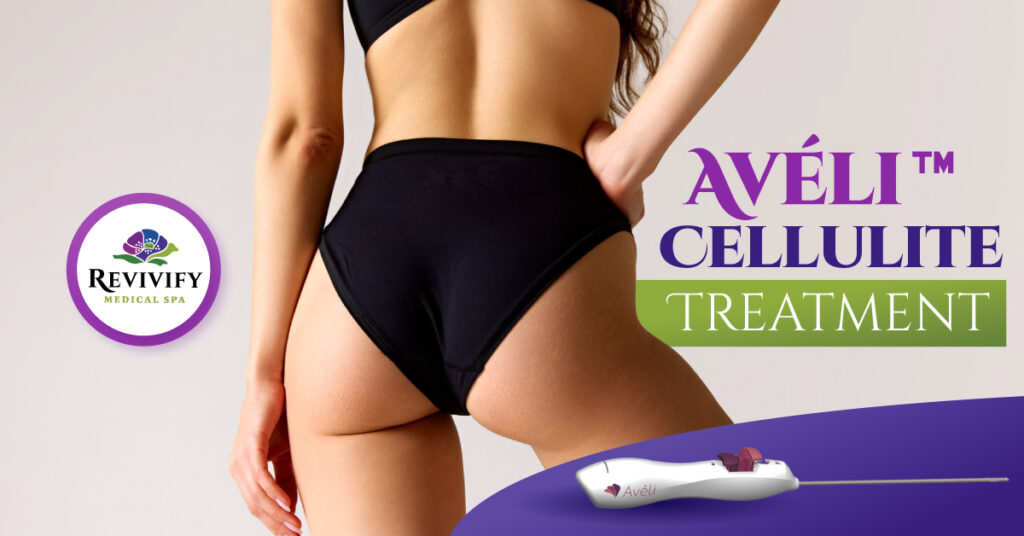 Avéli™ Cellulite Treatment