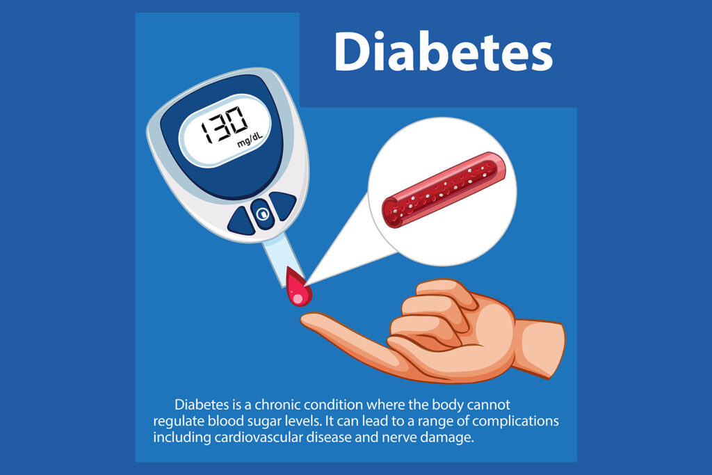 What are Diabetes and Prediabetes?
